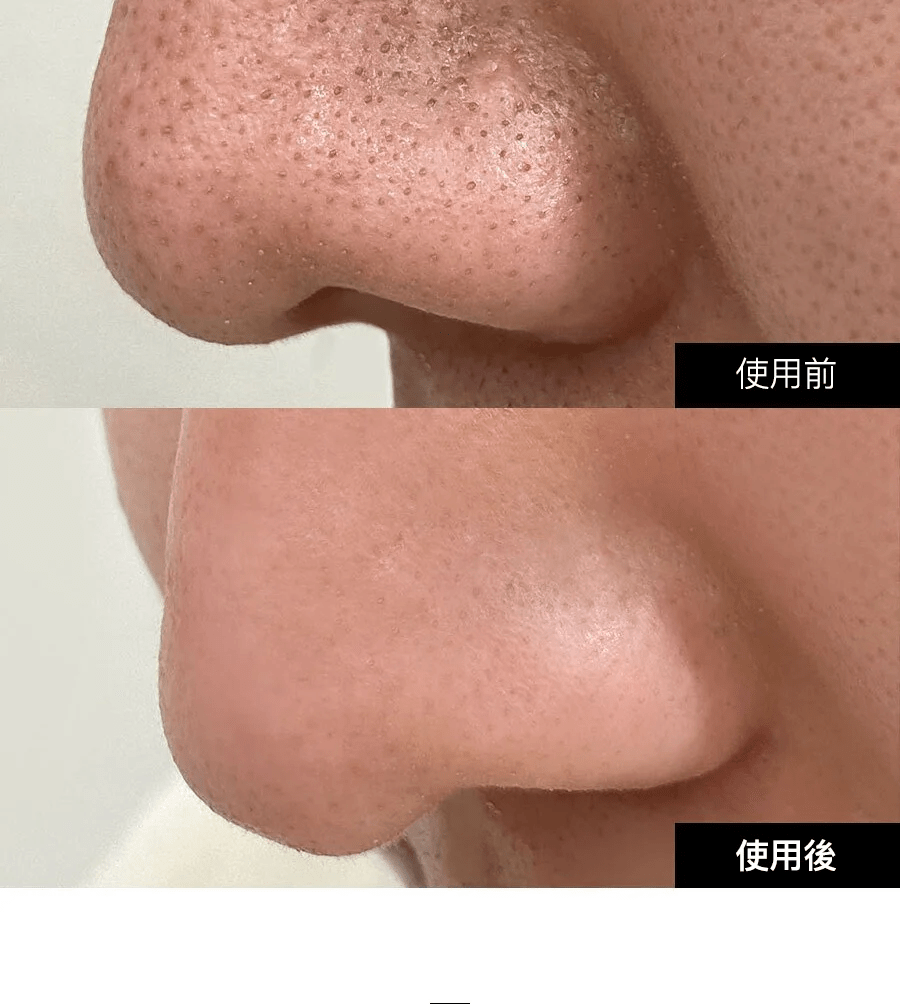 Beauty Suction