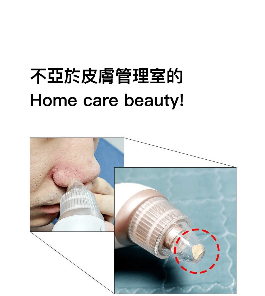 Beauty Suction