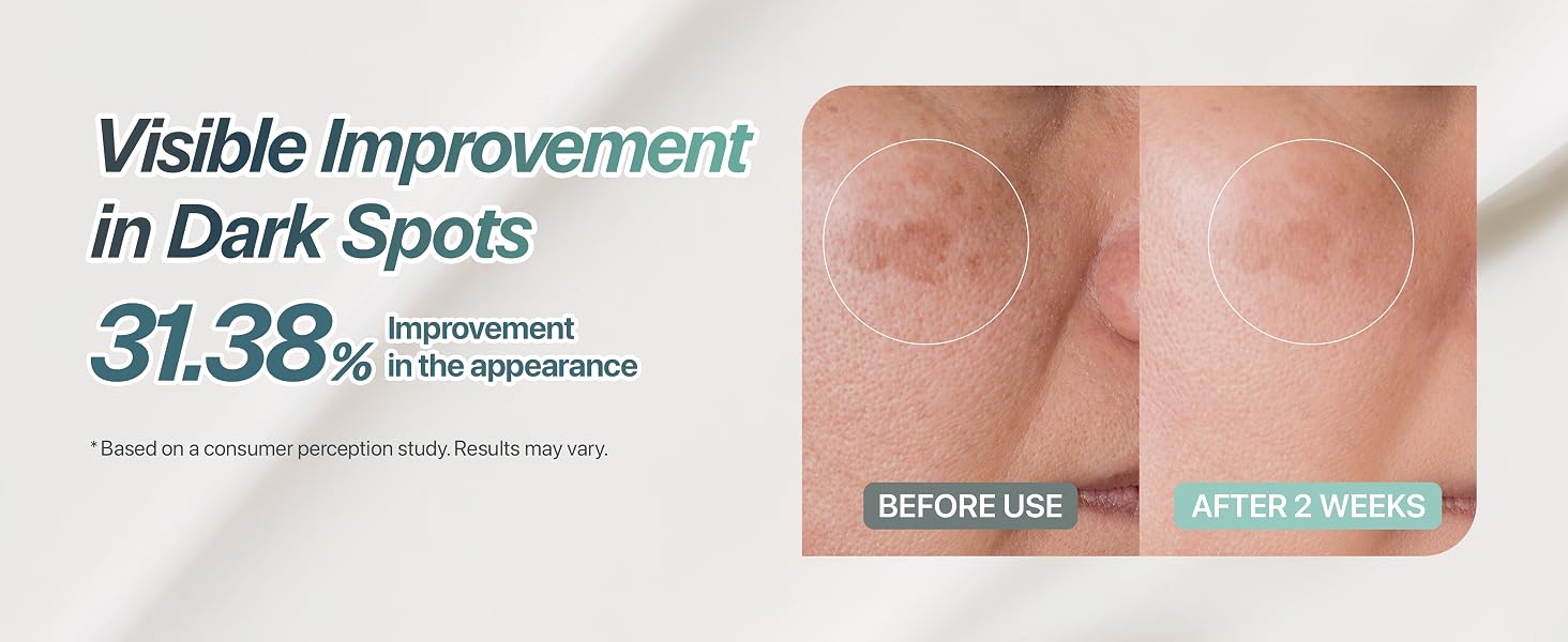 Image displaying consumer study results related to the appearance of dark spots over time