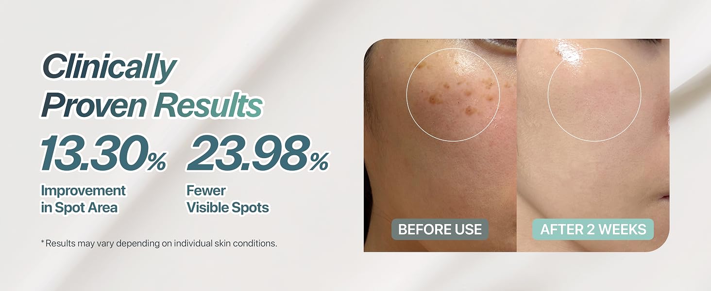 presenting clinical evaluation data related to visible dark spot appearance over time
